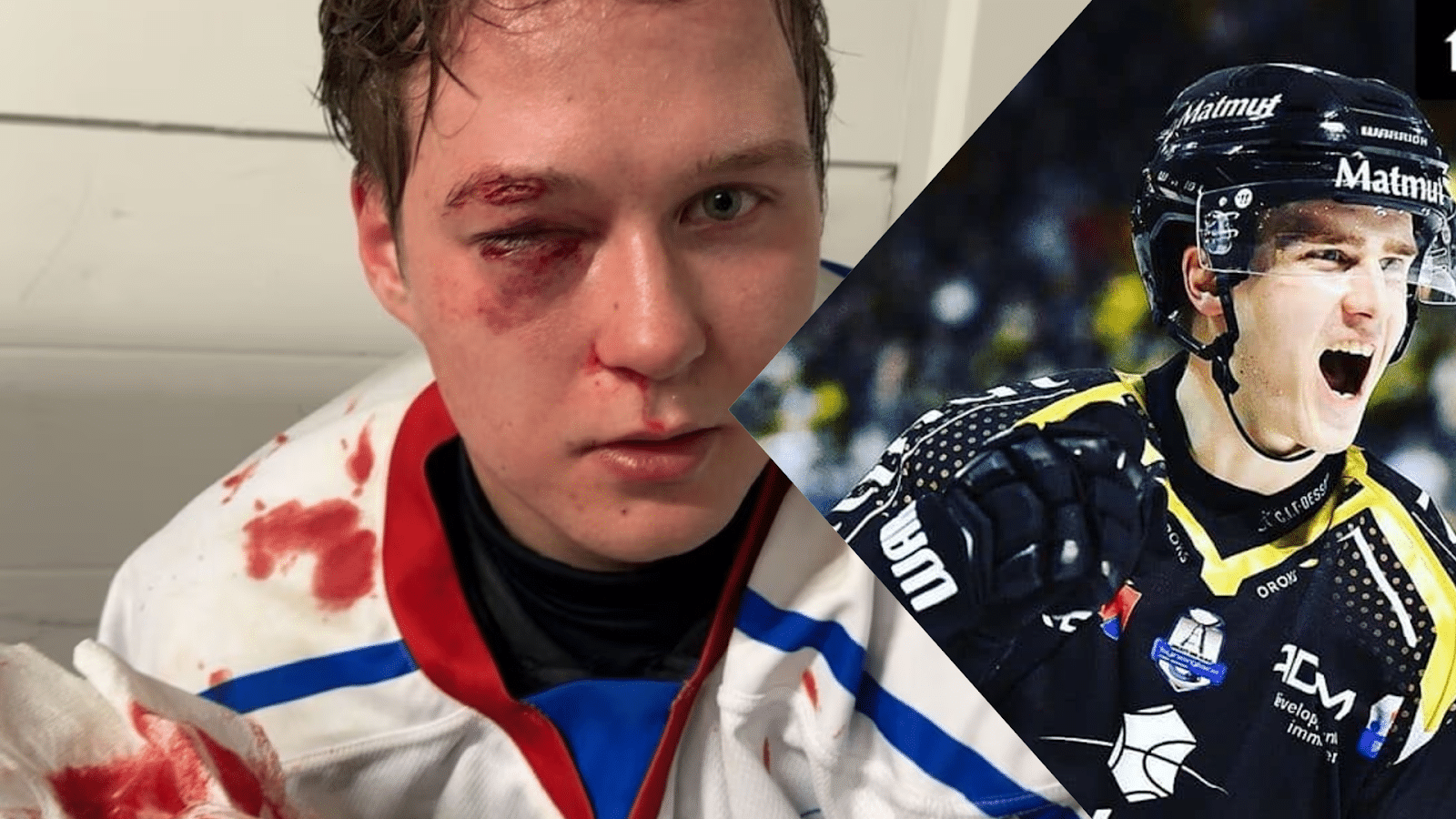 Atte Mäkinen sekosi täysin – vastustaja sairaalaan